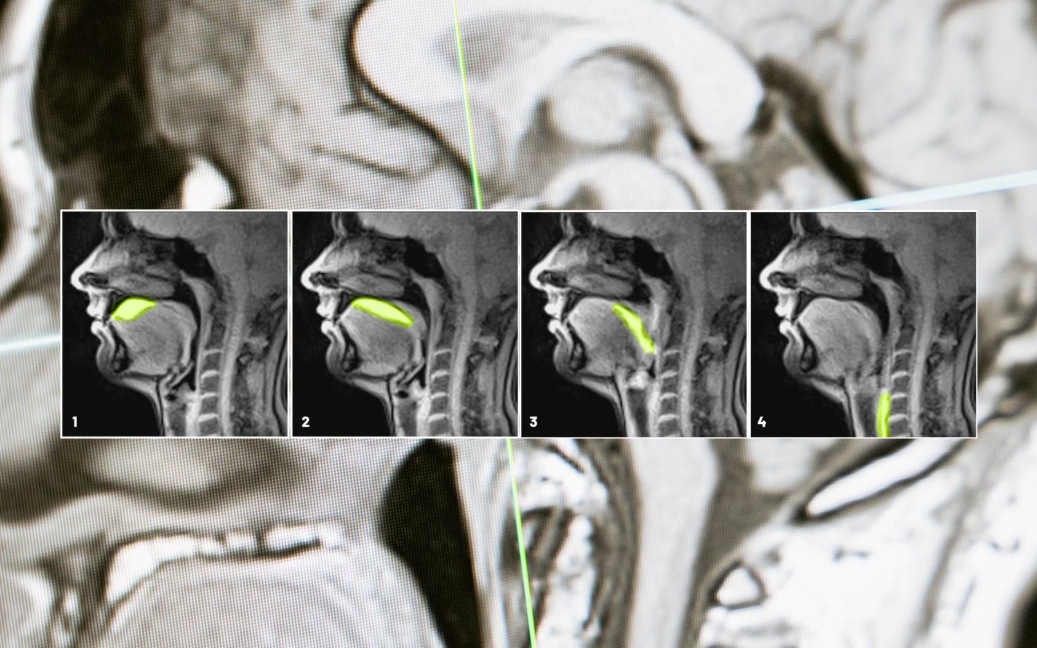 Function system mouth – Many symptoms, one cause