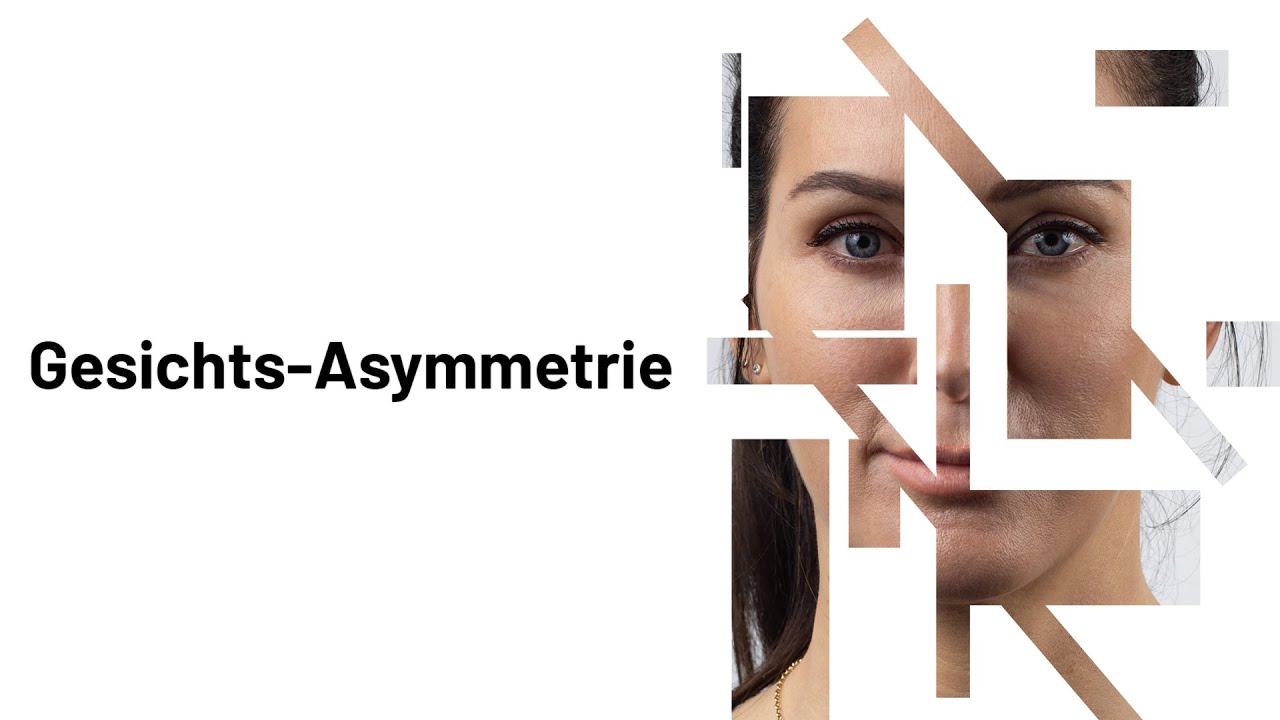 Gesichts-Asymmetrie – Wie kommt sie zustande und wie wird man sie los?
