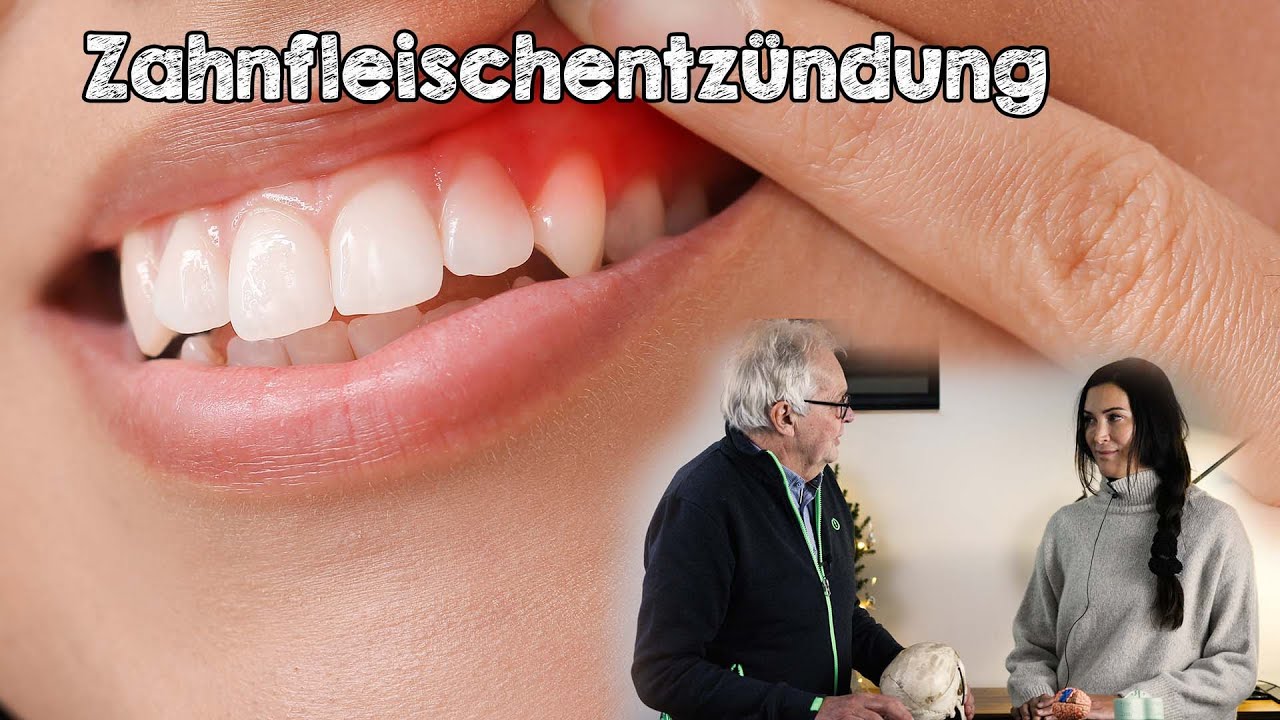 Richtig vorbeugen bei Zahnfleischentzündung, Parodontitis und Gingivitis