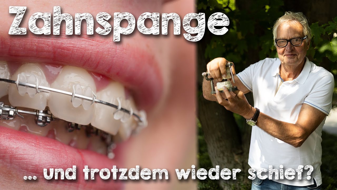 Trotz Zahnspange – Warum werden Zähne wieder schief?