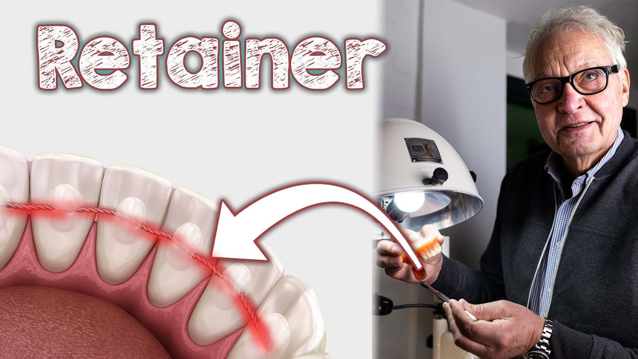 Retainer – Scheinbar harmlos – Tatsächlich aber mit negativen gesundheitlichen Folgen