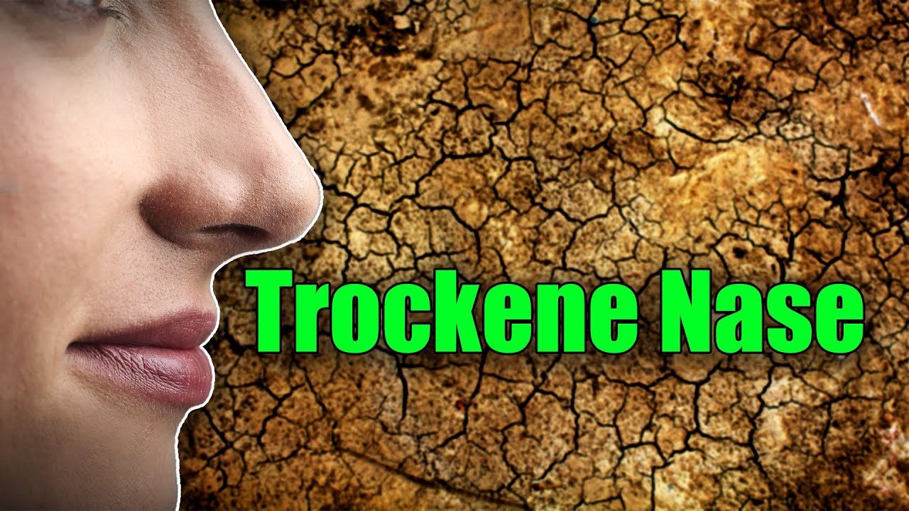Trockene Nase. Weiter schädigen durch Sprays? Operation? Nein! Hier die beste Lösung mit Dauereffekt